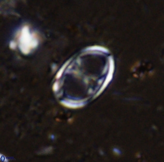 Asynithistostoichos coxalliae 36164