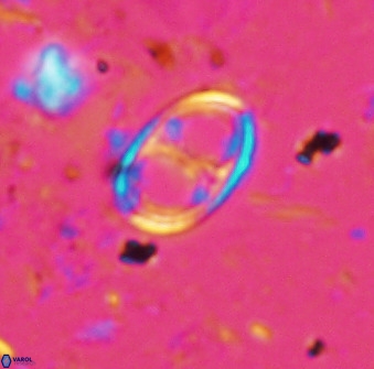 Asynithistostoichos coxalliae 36165