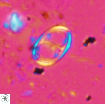 Asynithistostoichos coxalliae 36165