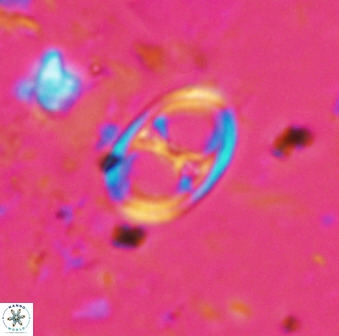 Asynithistostoichos coxalliae 36166