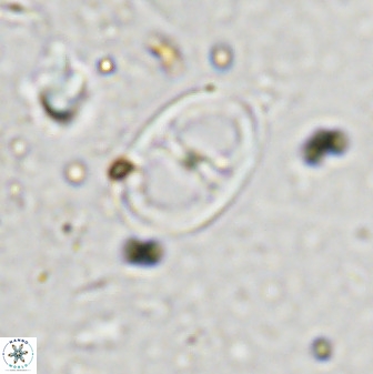 Asynithistostoichos coxalliae 36167