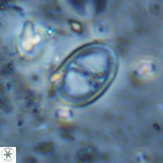 Asynithistostoichos coxalliae 36168