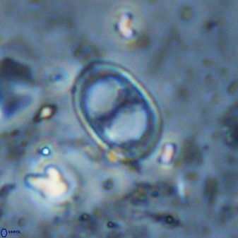 Asynithistostoichos coxalliae 36171