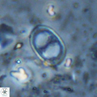 Asynithistostoichos coxalliae 36171