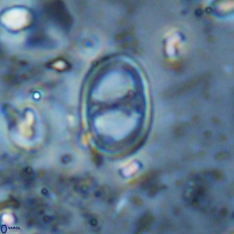 Asynithistostoichos coxalliae 36172