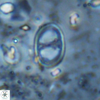Asynithistostoichos coxalliae 36172