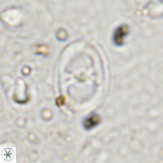 Asynithistostoichos coxalliae 36173