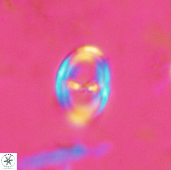 Asynithistostoichos coxalliae 37259