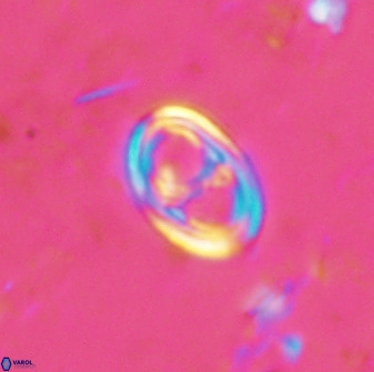 Asynithistostoichos coxalliae 37261