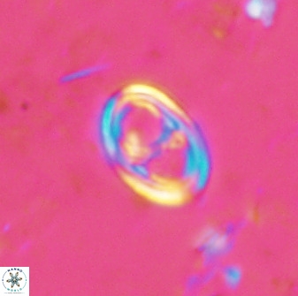 Asynithistostoichos coxalliae 37261