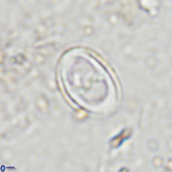 Asynithistostoichos coxalliae 37263