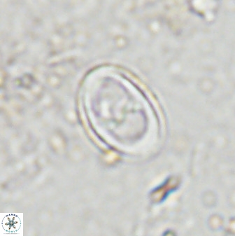 Asynithistostoichos coxalliae 37263