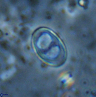 Asynithistostoichos coxalliae 37264