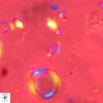 Mikrokaifoteino aplos VR 01461