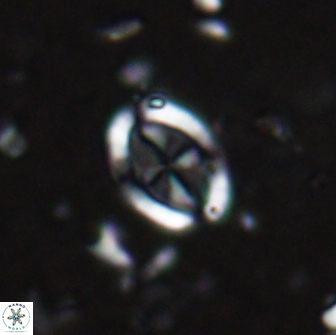 Arkhangelskiella octocentralis clivosa 14801