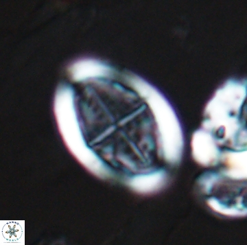 Arkhangelskiella orthocancellata 9945