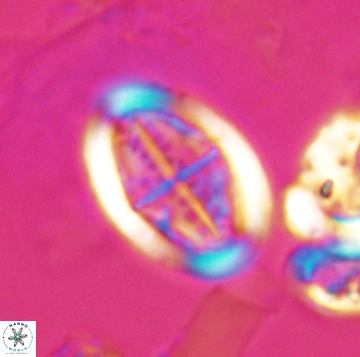 Arkhangelskiella orthocancellata 9946