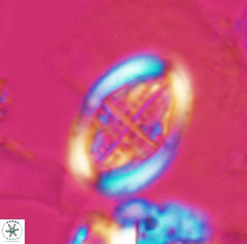 Arkhangelskiella orthocancellata 9950