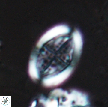 Arkhangelskiella orthocancellata 9951