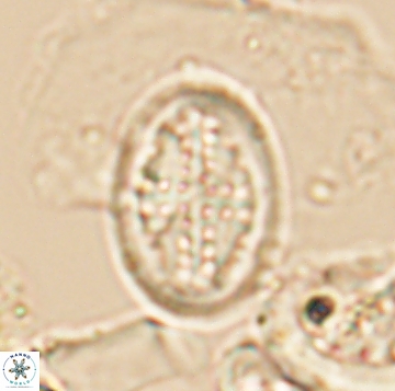 Arkhangelskiella orthocancellata 9952