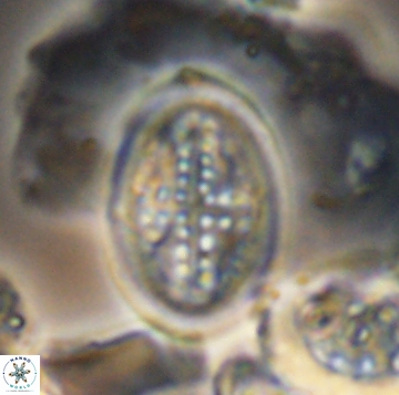 Arkhangelskiella orthocancellata 9953