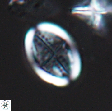 Arkhangelskiella orthocancellata 9964