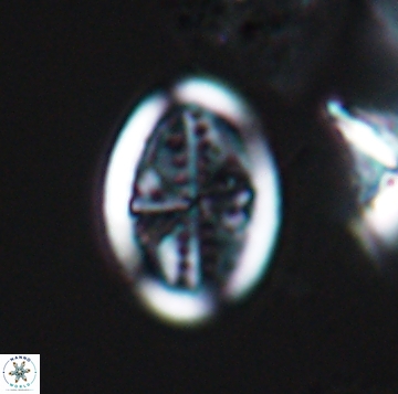 Arkhangelskiella orthocancellata 9966