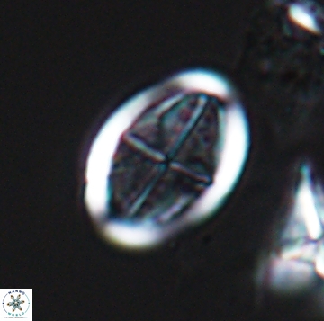 Arkhangelskiella orthocancellata 9968