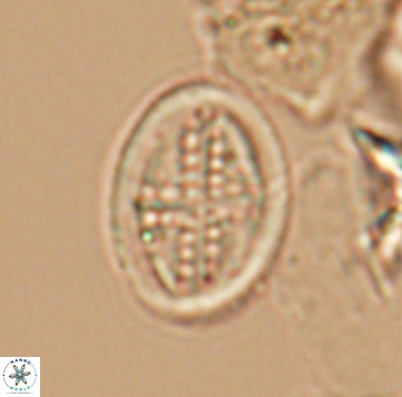 Arkhangelskiella orthocancellata 9970