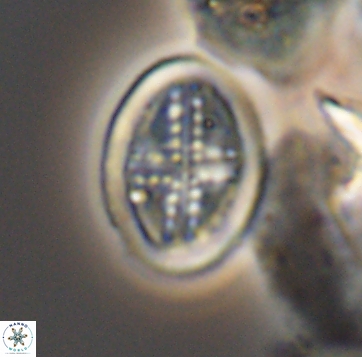Arkhangelskiella orthocancellata 9971