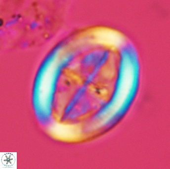 Arkhangelskiella inclinata L M 3027