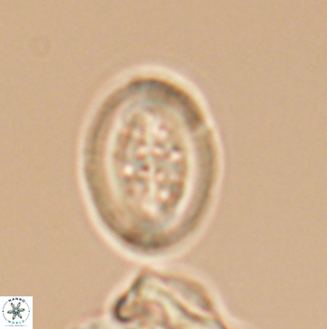 Arkhangelskiella paucipunctata ML M 12153