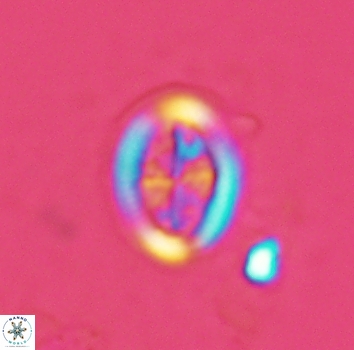 Arkhangelskiella paucipunctata ML N 3961