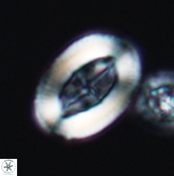 Arkhangelskiella paucipunctata ML W 12039