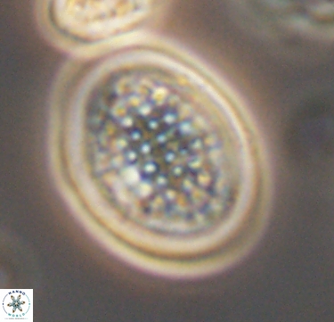 Arkhangelskiella specillata 10423