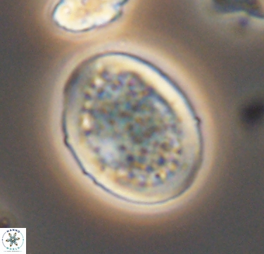 Arkhangelskiella specillata 10424