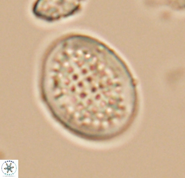 Arkhangelskiella specillata 10425
