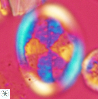 Arkhangelskiella specillata LM