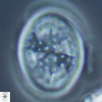 Arkhangelskiella specillata LM 17843