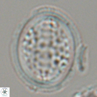 Arkhangelskiella specillata LM 17848