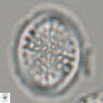 Arkhangelskiella specillata LM 17849