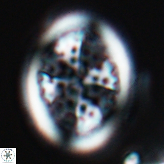 Arkhangelskiella specillata LM 17850