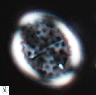 Arkhangelskiella specillata LM 17852