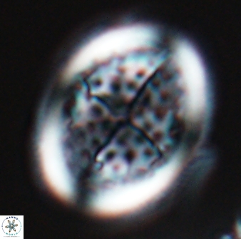 Arkhangelskiella specillata LM 17854