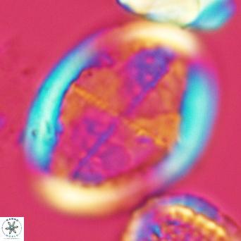 Arkhangelskiella specillata LM 3279