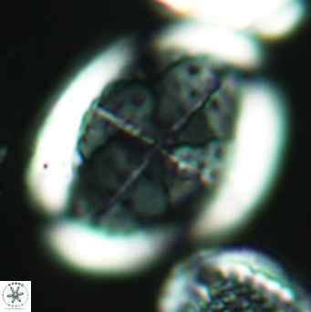 Arkhangelskiella specillata LM 3280