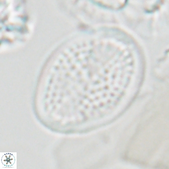 Arkhangelskiella specillata LN 18842