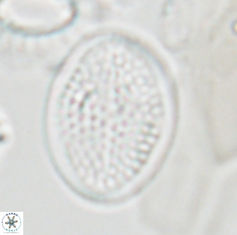 Arkhangelskiella specillata LN 18843