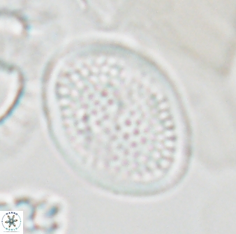 Arkhangelskiella specillata LN 18844