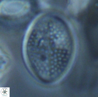 Arkhangelskiella specillata LN 18846